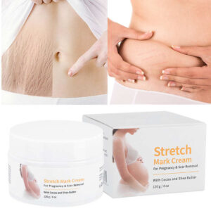 Melao Stretch Mark Cream – Scar Removal – 120g