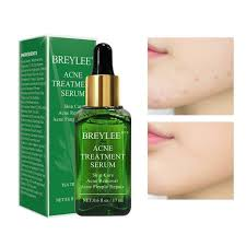 Breylee Acne Treatment Serum – 17ml